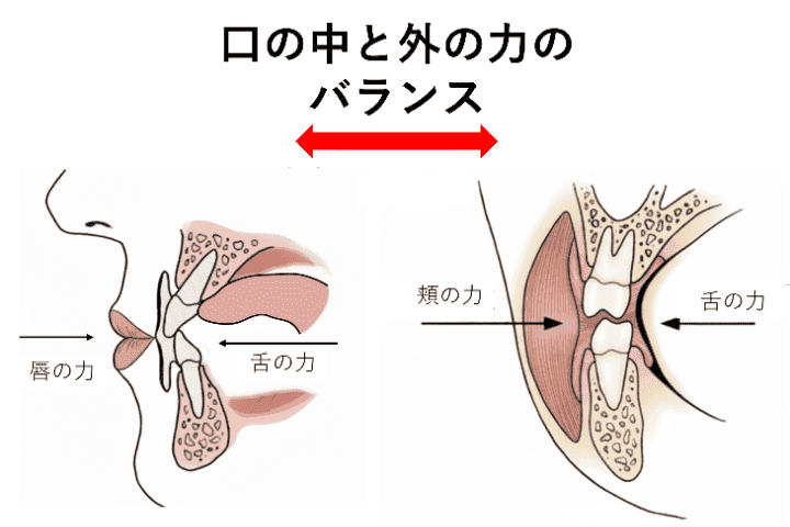 バクシネーターメカニズム図解

