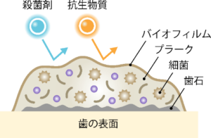 バイオフィルム