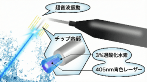 ブルーラジカル
